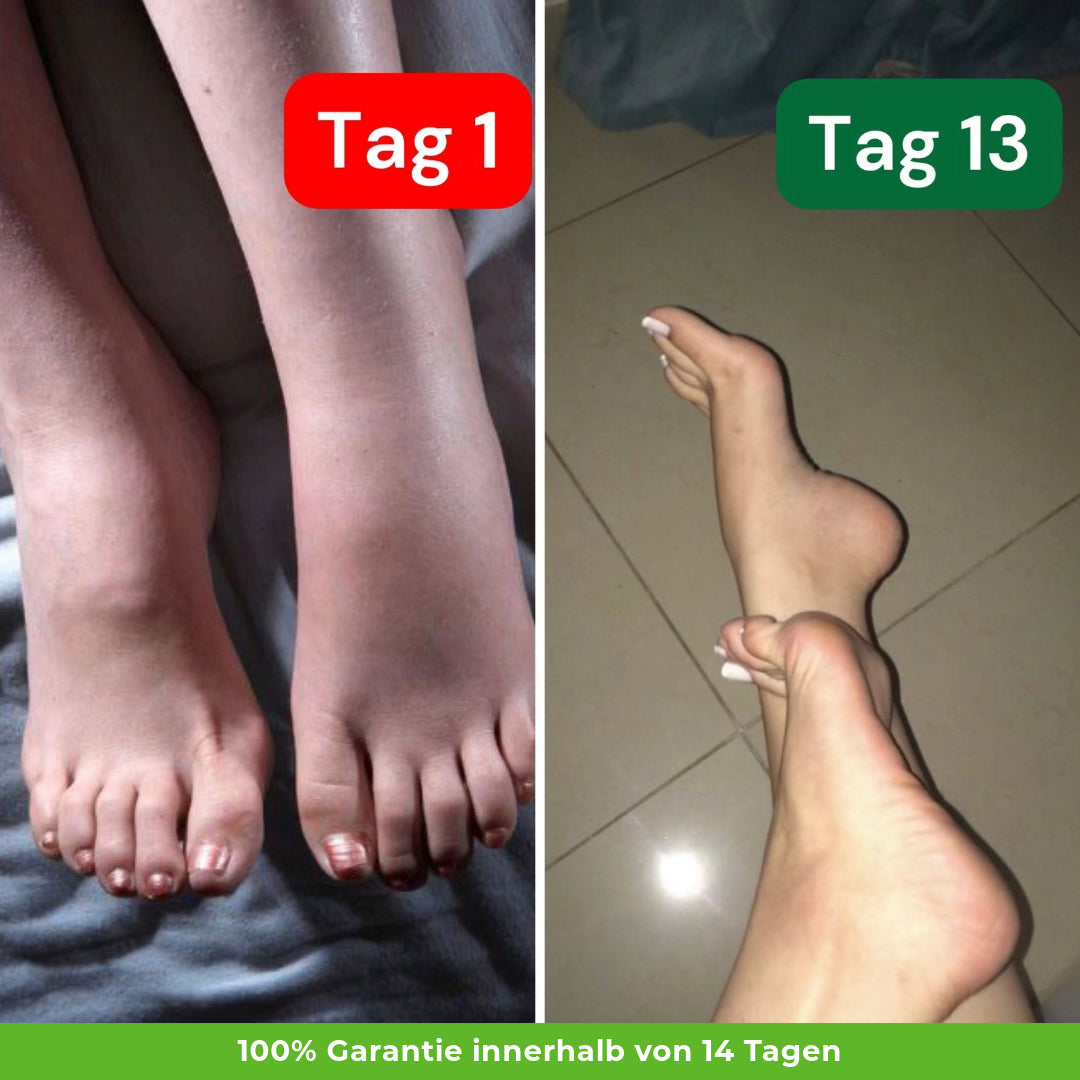 Kompressionsstrümpfe für mehr Lebensqualität