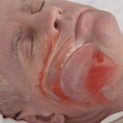 YouCure™ Anti-Schnarch-Mundstück